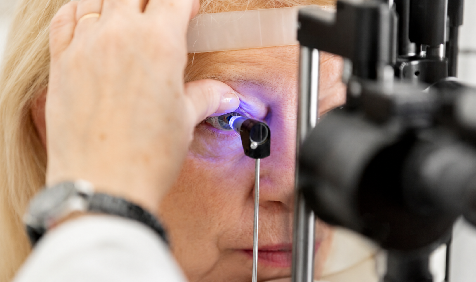 Glaucoma